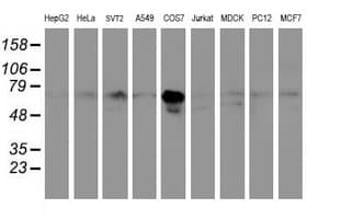 PPAT Antibody (aa42-278, clone OTI1B2)