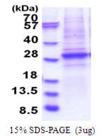 Human SMARCA4 / BRG1 Protein (Recombinant His)