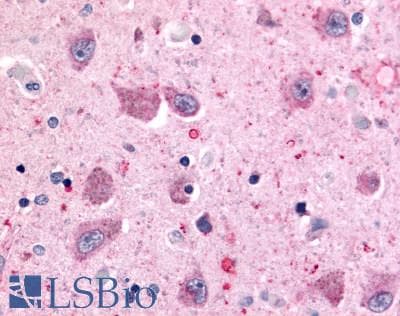 PathPlus™ ADGRB2 / BAI2 Antibody (N-Terminus)
