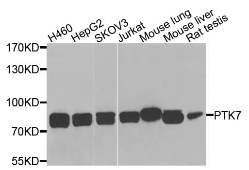 Polyclonal Rabbit anti-Human CCK4 / PTK7 Antibody (IHC, WB)