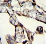 Polyclonal Rabbit anti-Human SASH1 Antibody (aa596-625, IHC, WB)