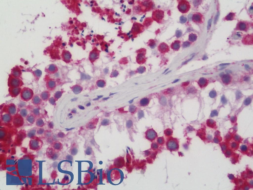 IHC-plus™ Polyclonal Rabbit anti-Human HSP90B1 / GP96 / GRP94 Antibody (aa16-43, IHC, IF, WB)