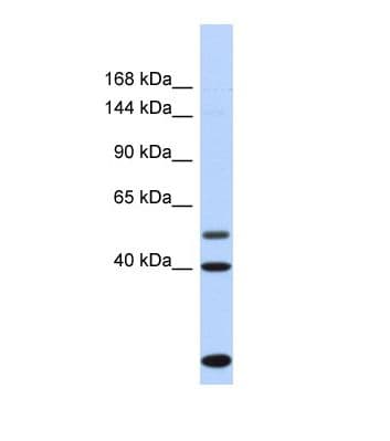 PSD3 Antibody (C-Terminus)