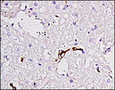 Polyclonal Rabbit anti-Mouse F8 / FVIII / Factor VIII Antibody (IHC, IF, WB)