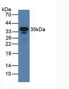 FCER2 / CD23 Antibody (aa150-330, APC, Cy7)