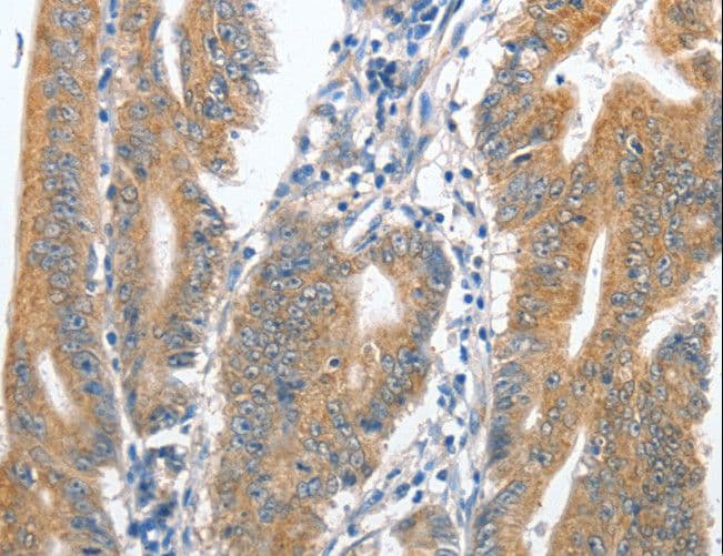 CENPC / CENP-C Antibody