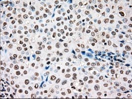 TYRO3 Antibody (clone OTI2C4)