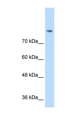 Polyclonal Rabbit anti-Human DLG2 / PSD93 Antibody (N-Terminus, IHC, WB)