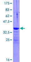 Human INVS / Inversin Protein (Recombinant GST)