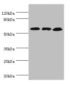 IHC-plus™ GLUD2 Antibody (aa319-558)