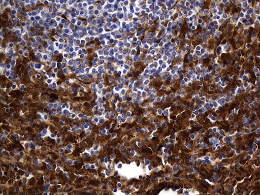 M-PST / STM Antibody (clone OTI1C6)
