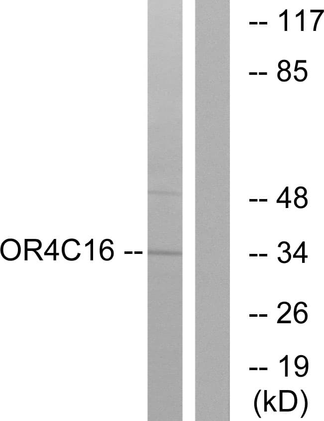 OR4C16 Antibody (aa261-310)