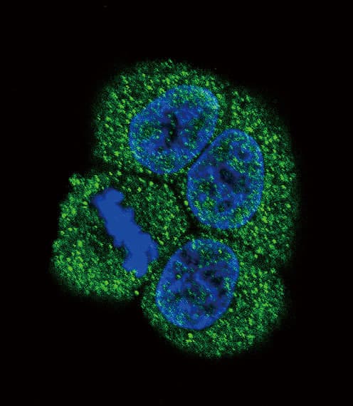 Polyclonal Rabbit anti-Human KDR / VEGFR2 / FLK1 Antibody (aa1326-1356, IHC, IF, WB)