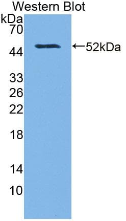 MGMT Antibody (aa1-209, Cy3)