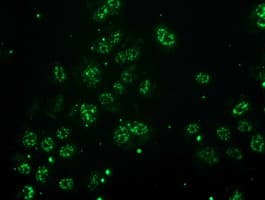 MGLL / Monoacylglycerol Lipase Antibody (clone OTI2B11)