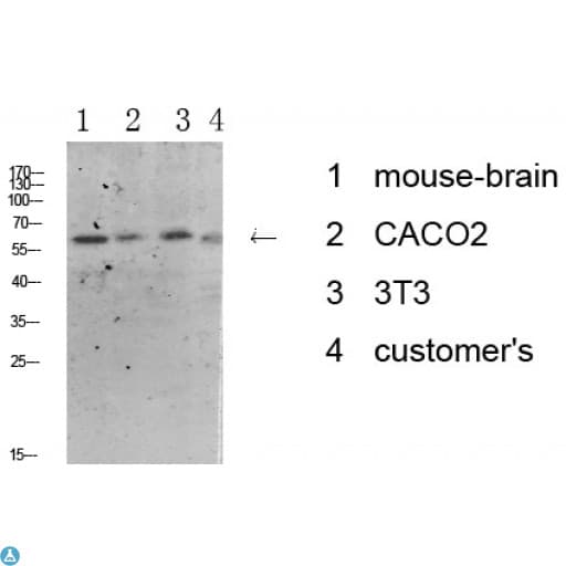Polyclonal Rabbit anti-Human Tyrosine Hydroxylase Antibody (WB)