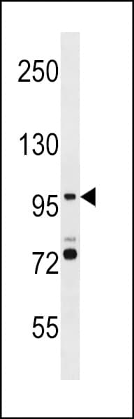 SMG5 Antibody (aa912-941)
