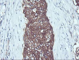 RALB Antibody (clone OTI2C4)