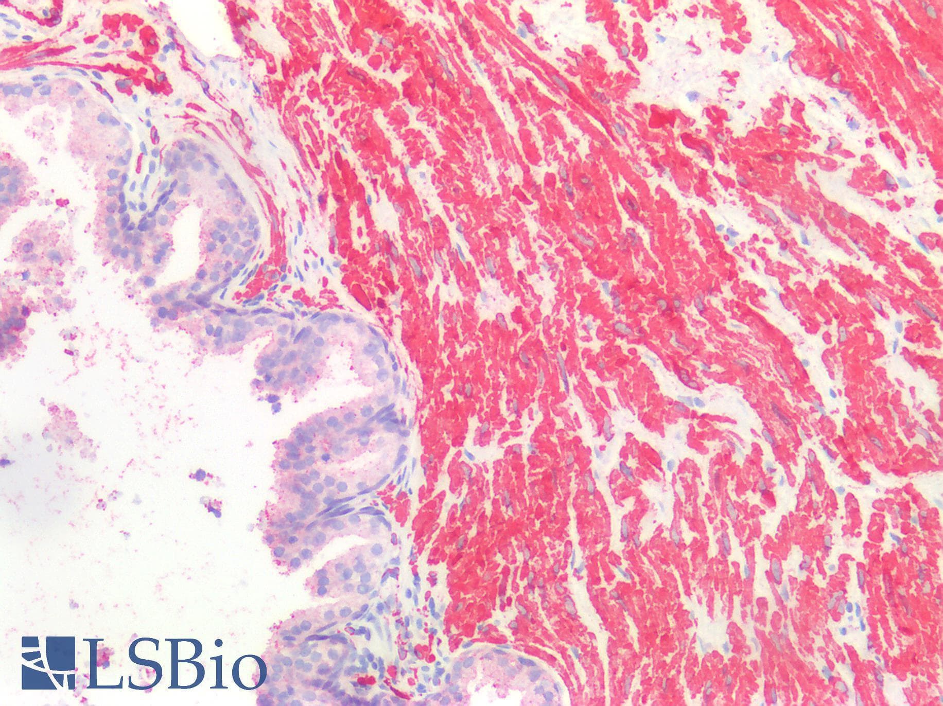 SMMHC / MYH11 Antibody