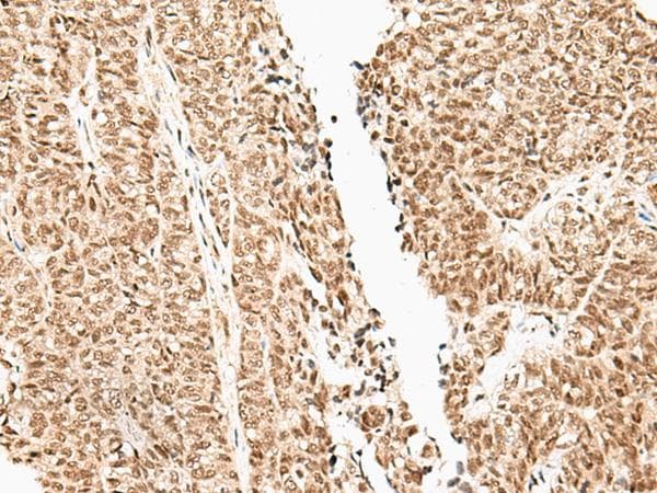 Polyclonal Rabbit anti-Human FUT3 Antibody (IHC)