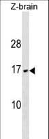 VAMP3 / VAMP-3 Antibody (aa15-43)