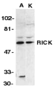 RICK / RIP2 Antibody