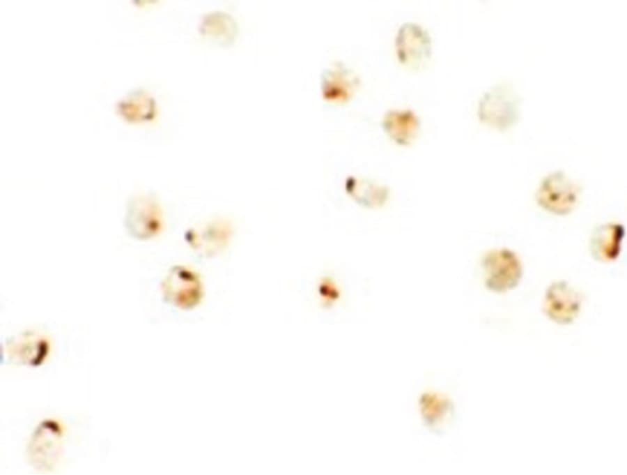Polyclonal Rabbit anti-Human IRF2BP2 Antibody (WB)