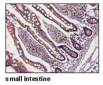 SLC17A9 / C20orf59 Antibody