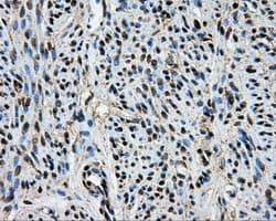 Monoclonal Mouse anti-Human BRAF / B-Raf Antibody (clone OTI1E2, IHC, IF, WB)