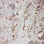 PR / Progesterone Receptor Antibody (aa595-933)