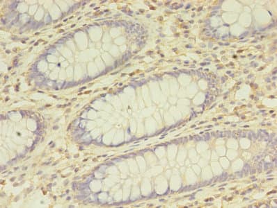 BTN3A1 / CD277 Antibody