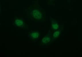 TUBB2B / Tubulin Beta 2B Antibody (clone OTI5D3)