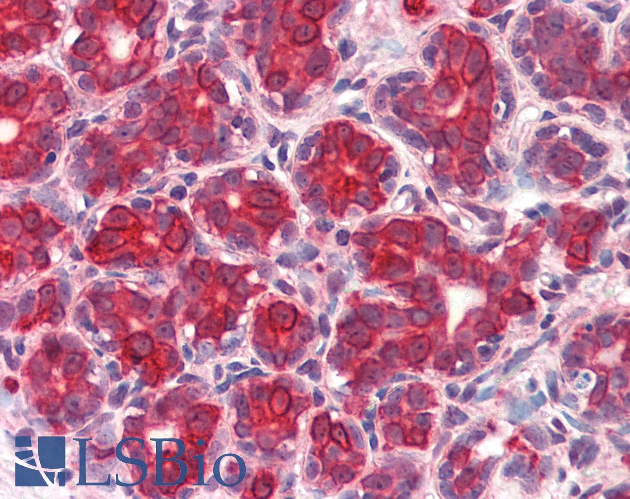 IHC-plus™ Polyclonal Rabbit anti-Human GM2A Antibody (Internal)