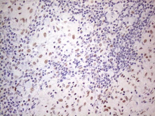 TDG / Thymine DNA Glycosylase Antibody (aa160-253, clone OTI3C11)