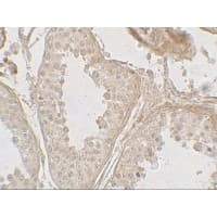 GLIPR1L2 Antibody