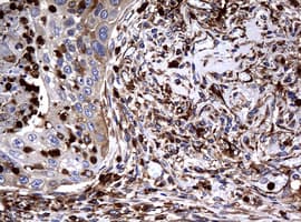 RASGRP3 / GRP3 Antibody (aa380-690, clone OTI2C11)