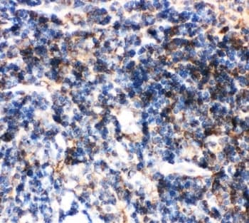 Polyclonal Rabbit anti-Human BID Antibody (aa1-195, IHC, WB)