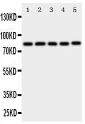 Polyclonal Rabbit anti-Human XRCC5 / Ku80 Antibody (aa648-662, IHC, WB)