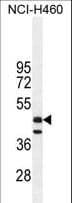 FGL2 Antibody (aa338-367)