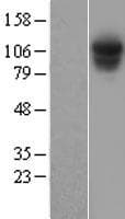 Human PSMD1 Protein (Over-Expression Lysate Myc-DDK (Flag))
