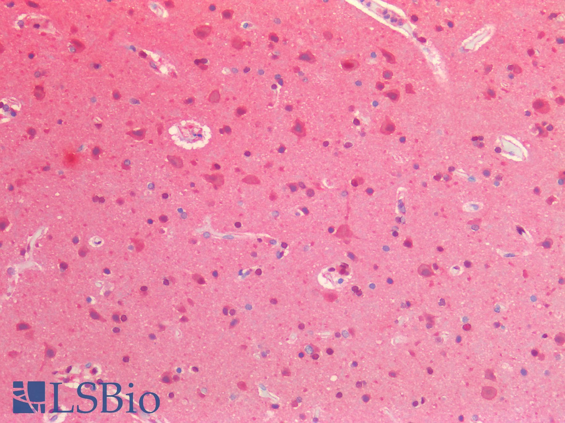 IHC-plus™ VCP Antibody (Internal Region)