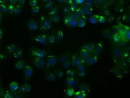 NIT1 Antibody (clone OTI3A11)