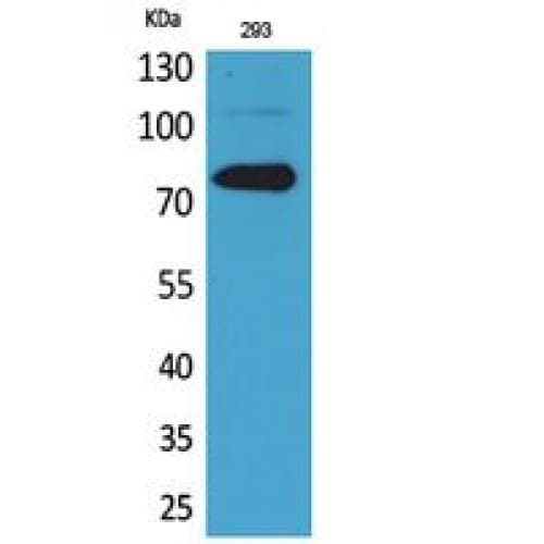 BTK Antibody (490-570 aa)