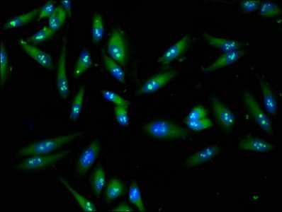 FASN / Fatty Acid Synthase Antibody (aa2155-2495)