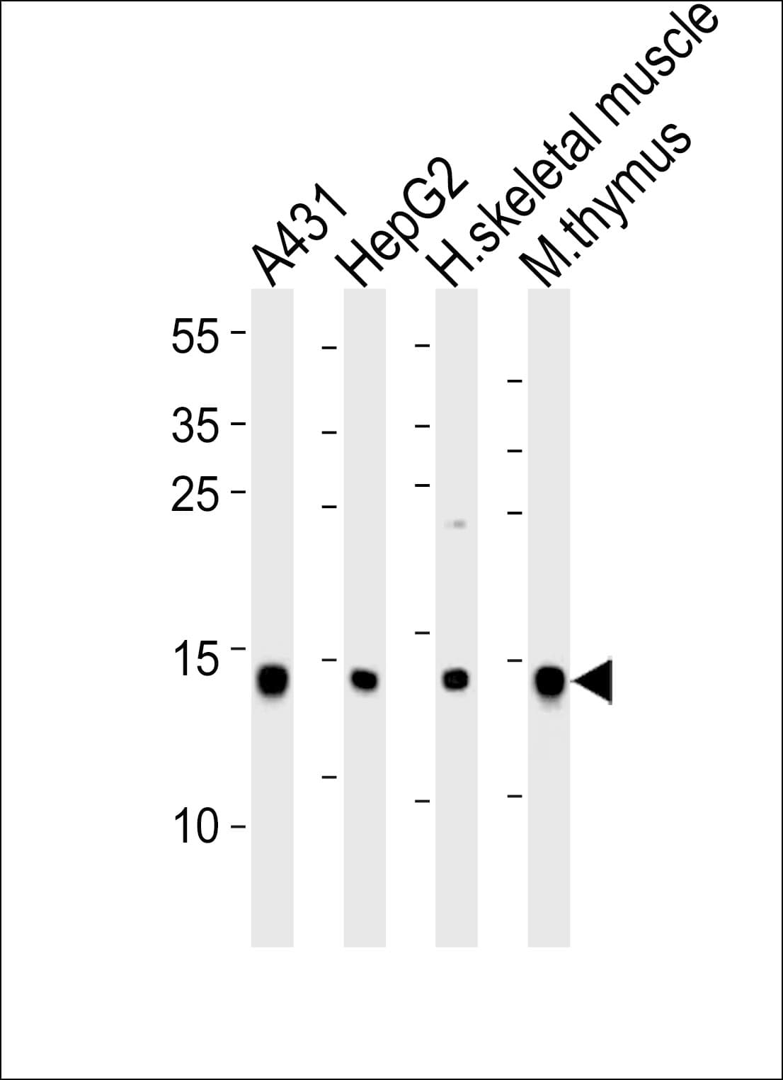 IHC-plus™ Polyclonal Rabbit anti-Human UBE2D1 / UBCH5 Antibody (aa111-140, IHC, WB)