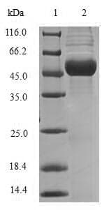 Human MEOX1 Protein (Recombinant GST, N-terminus)