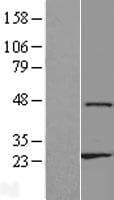 ZNF659 / ZNF385D Protein (Over-Expression Lysate Myc-DDK (Flag))