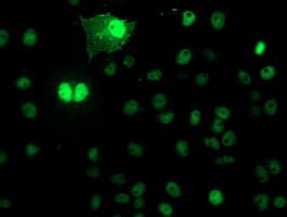 NAPE-PLD Antibody (clone OTI5F7)