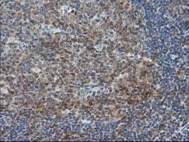 Monoclonal Mouse anti-Human STAT5A Antibody (clone OTI9A5, IHC, IF, WB)