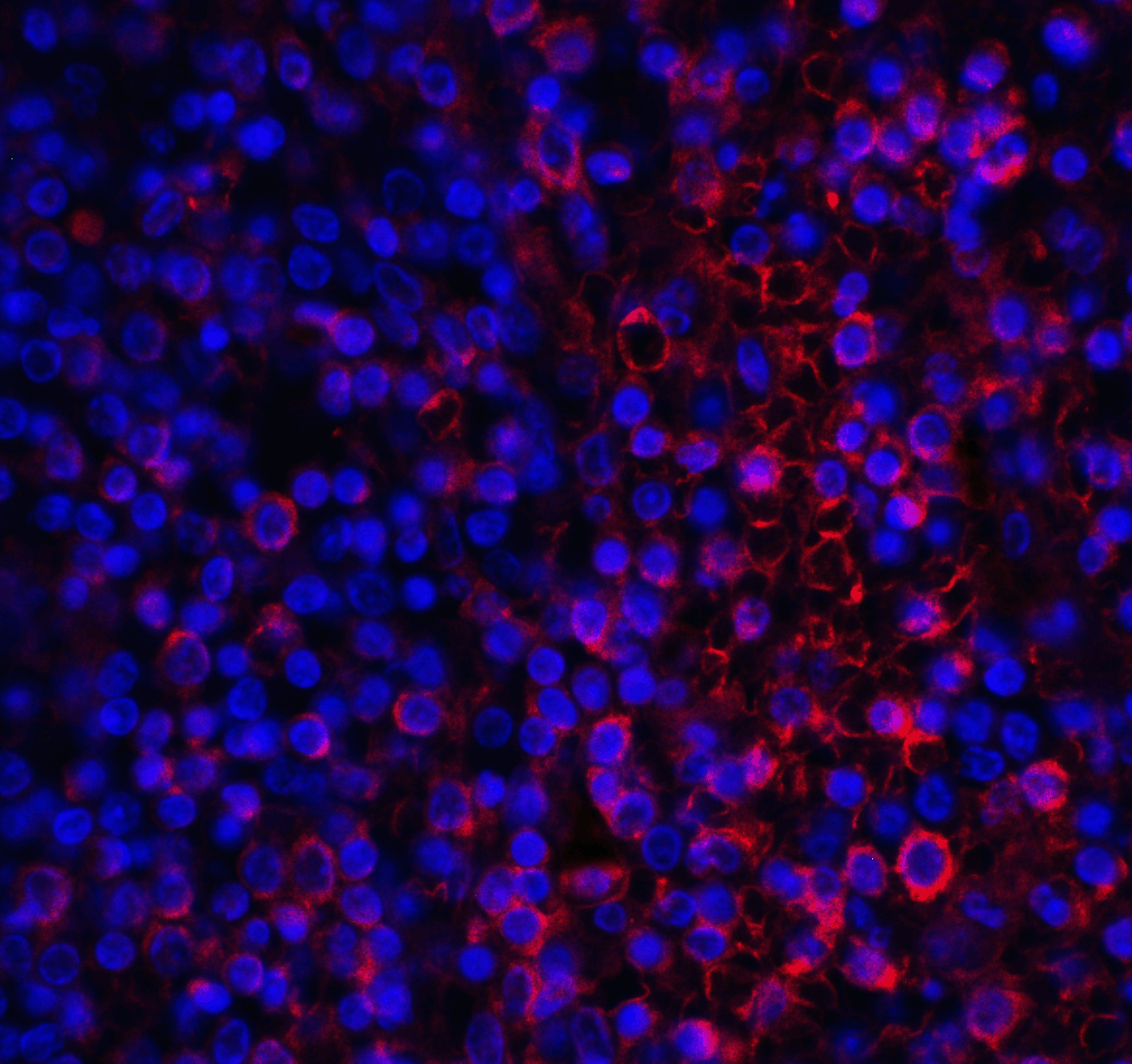 IHC-plus™ VSIR / GI24 / VISTA Antibody (clone 8E11)